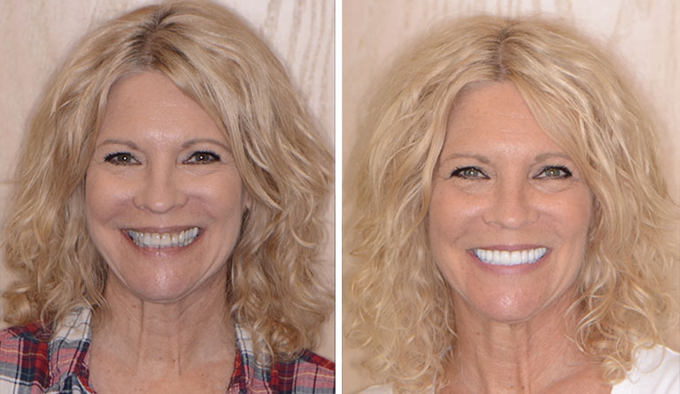 Cosmetic Dentist Shelby Township