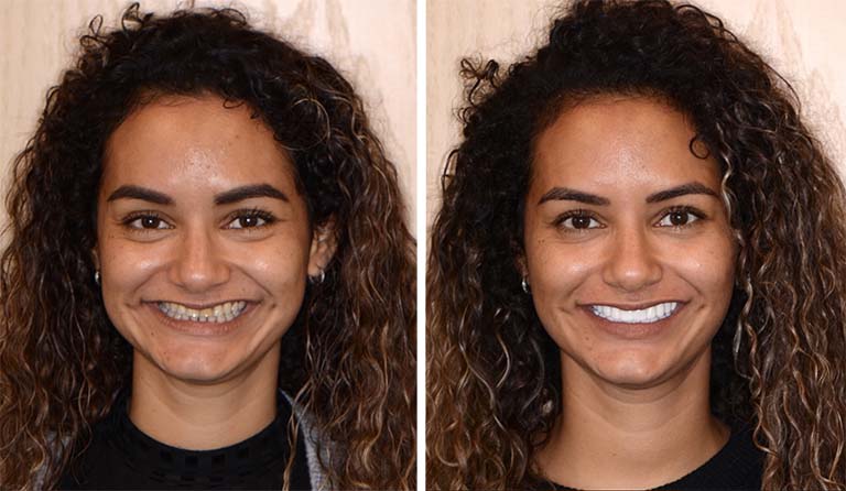 Dentist In Shelby Township Mi