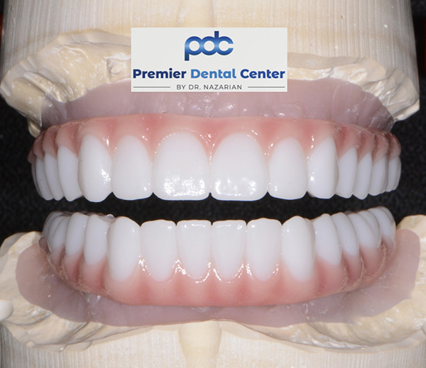 Implant Dentist in Shelby Township MI Implant Dentist in Shelby Township MI